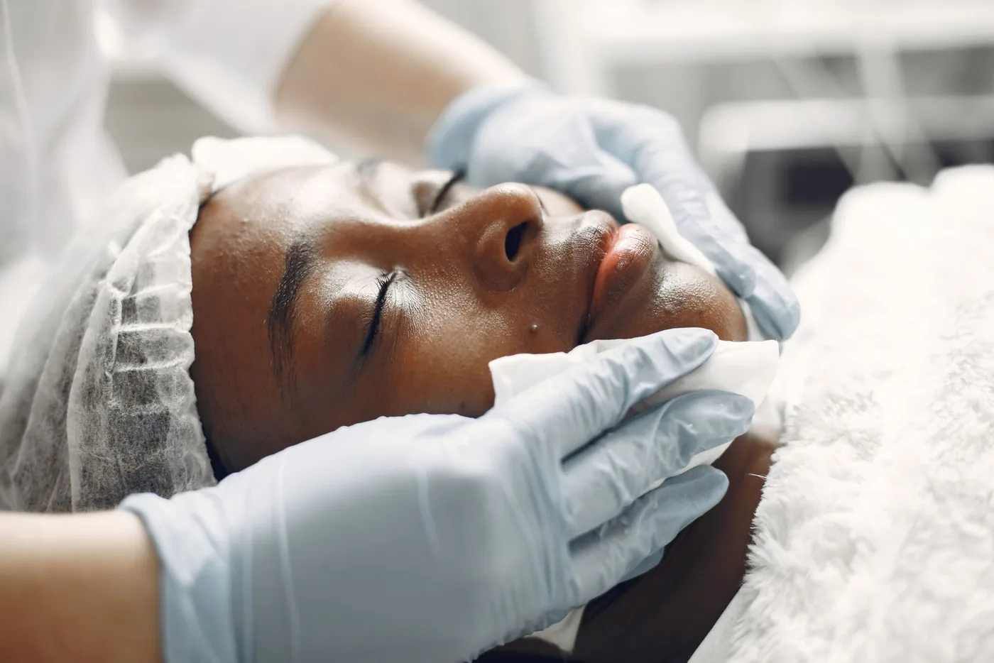 Facial Treatments results